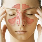 natural treatment of sinusitis