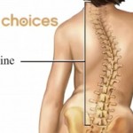 natural permanent cure of Scoliosis