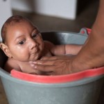 natural treatment of zika virus