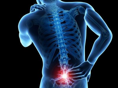 stenosis induced back pain without surgery