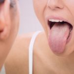 Natural cure of Thrush for relief within hours