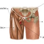 Fast natural cure for groin strain
